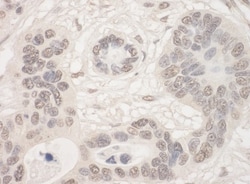 THOC2 Antibody, Novus Biologicals 100 &mu;L | Buy Online | Novus Biologicals | Fisher Scientific